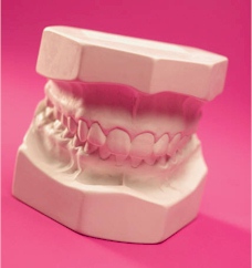 a fake set of dentures